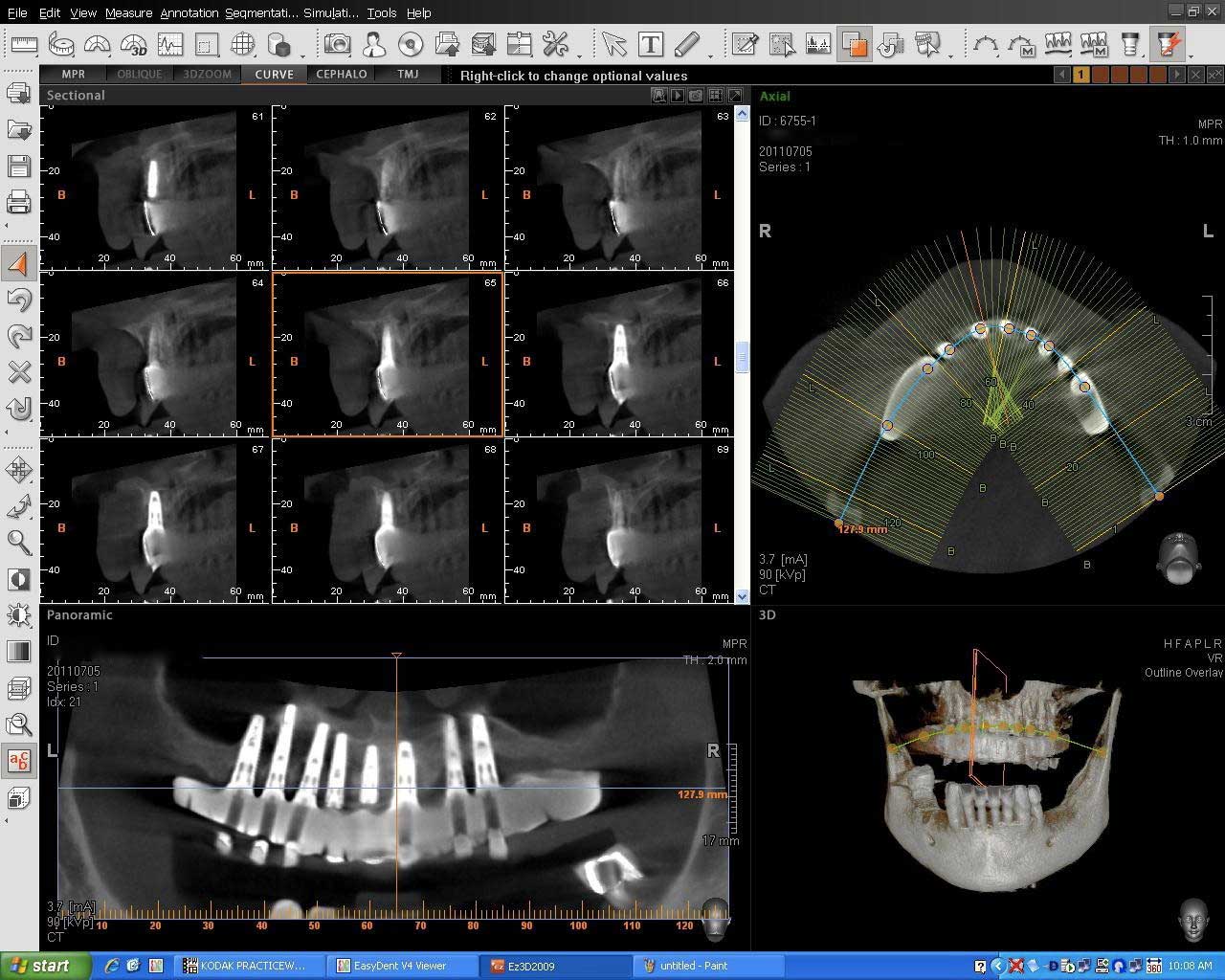 CBCT21