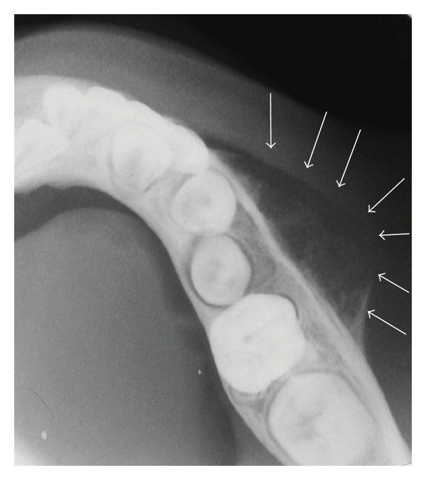 Mis- or Missed Diagnosis9
