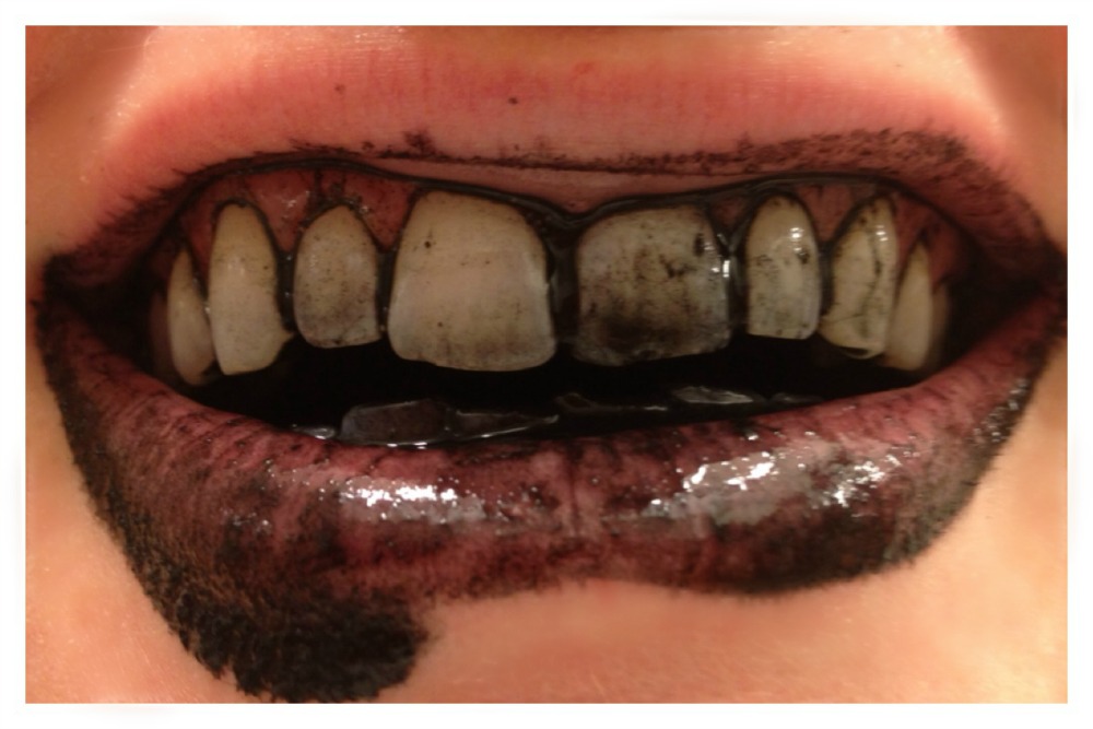 charcoal teeth whitening trend6